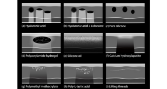 Echographie fillers