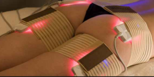 Laser de faible intensité cellulite