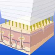 radiofréquence microneedlée technologie